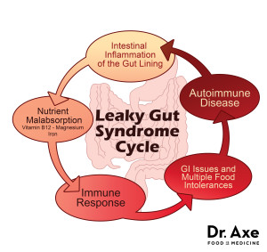 Leaky Gut Syndrome #fibromyalgia #leakygut